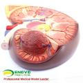KIDNEY02 (12431) Oversize Plastic Kidney mit Stand 3 Time Vergrößern Life Size Medizinische Anatomie